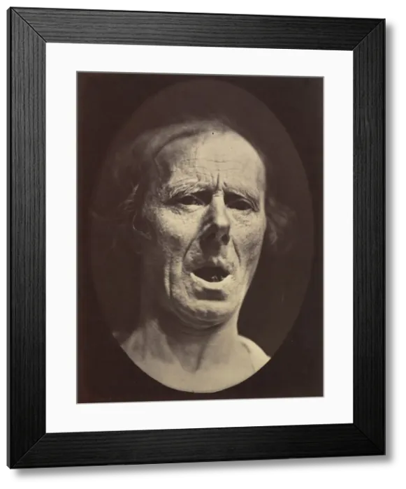 Framed Print : Figure 54: Voluntary lowering of the lower jaw, 1854-56, printed 1862 Framed Print : Figure 54: Voluntary lowering of the lower jaw, 1854-56, printed 1862