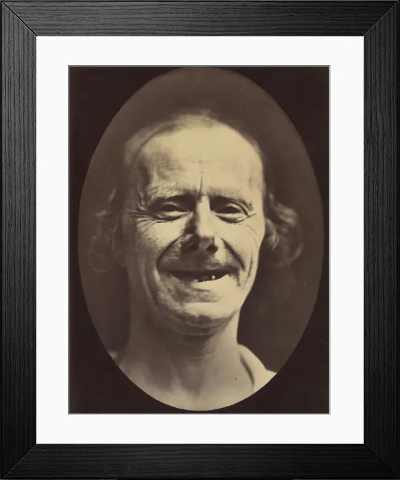 Framed Print : Figure 52: Voluntary retraction of the lower lip, 1854-56, printed 1862 Framed Print : Figure 52: Voluntary retraction of the lower lip, 1854-56, printed 1862
