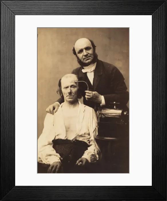 Framed Print : Faradisation du muscle frontal, 1854-56, printed 1862. Creators: Duchenne de Boulogne Framed Print : Faradisation du muscle frontal, 1854-56, printed 1862. Creators: Duchenne de Boulogne