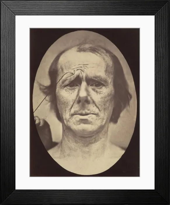 Framed Print : Figure 19: Suffering, 1854-56, printed 1862. Creators: Duchenne de Boulogne Framed Print : Figure 19: Suffering, 1854-56, printed 1862. Creators: Duchenne de Boulogne