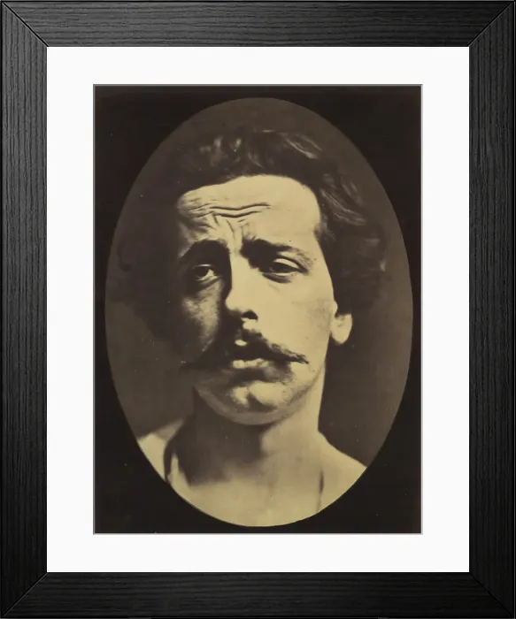 Framed Print : Figure 24: Extreme pain to the point of exhaustion, the head of Christ an Framed Print : Figure 24: Extreme pain to the point of exhaustion, the head of Christ an