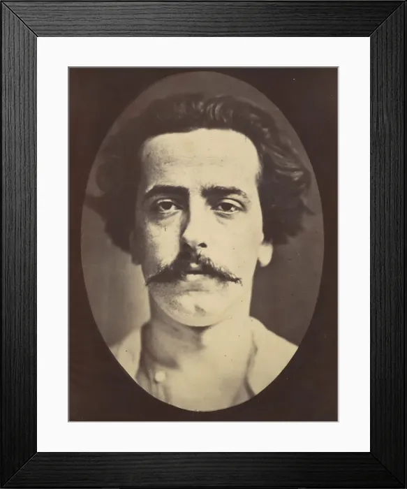 Framed Print : Figure 4: The face in repose of a young man, 1854-56, printed 1862 Framed Print : Figure 4: The face in repose of a young man, 1854-56, printed 1862