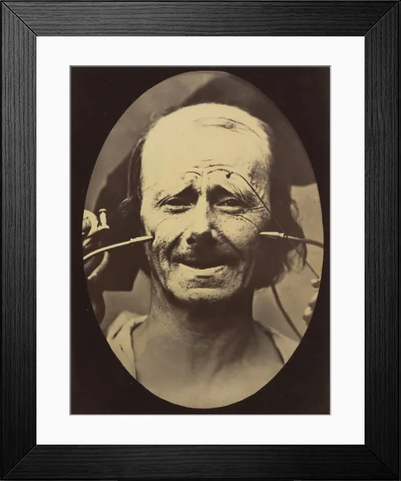 Framed Print : Figure 34: Grimace, 1854-56, printed 1862. Creators: Duchenne de Boulogne Framed Print : Figure 34: Grimace, 1854-56, printed 1862. Creators: Duchenne de Boulogne