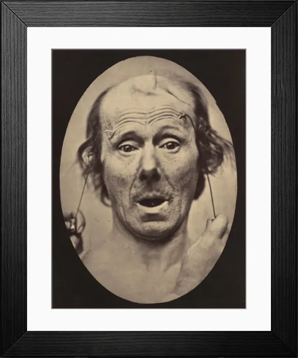 Framed Print : Figure 56: Surprise, 1854-56, printed 1862. Creators: Duchenne de Boulogne Framed Print : Figure 56: Surprise, 1854-56, printed 1862. Creators: Duchenne de Boulogne
