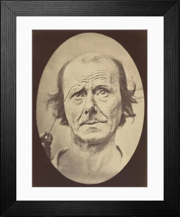 Framed Print : Figure 21: Painful recollection and recollection or calling something to Framed Print : Figure 21: Painful recollection and recollection or calling something to