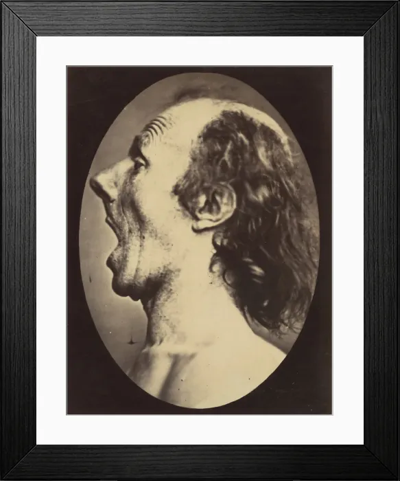 Framed Print : Figure 55: Astonishment badly rendered by the subject: a ridiculous and i Framed Print : Figure 55: Astonishment badly rendered by the subject: a ridiculous and i