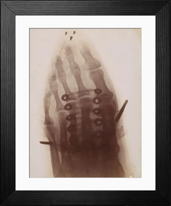 Framed Print : Le pied a travers la chaussure, 1896. Creator: Henri van Heurck Framed Print : Le pied a travers la chaussure, 1896. Creator: Henri van Heurck