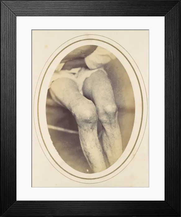 Framed Print : Frederick Hohmann, 1865. Creator: Reed Brockway Bontecou Framed Print : Frederick Hohmann, 1865. Creator: Reed Brockway Bontecou