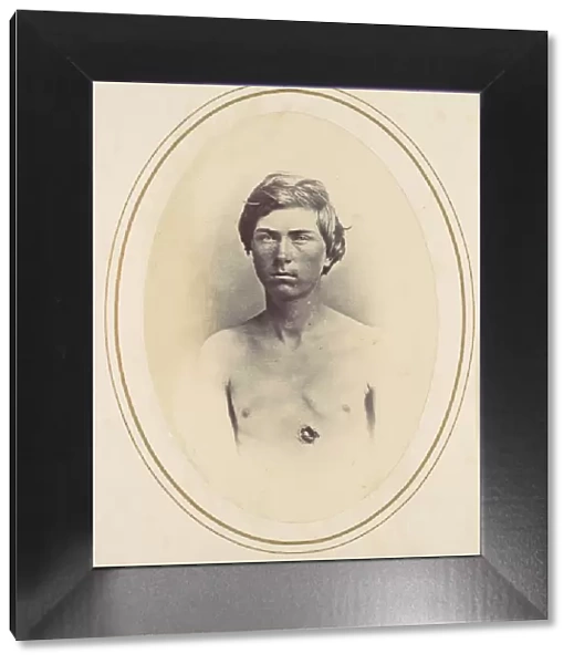 Frederick A. Bentley, 1865. Creator: Reed Brockway Bontecou
