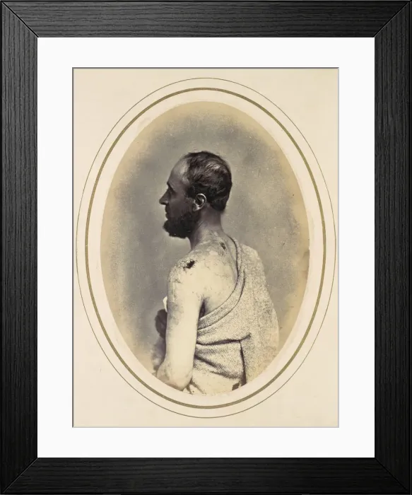 Framed Print : Henry Yon, 1865. Creator: Reed Brockway Bontecou Framed Print : Henry Yon, 1865. Creator: Reed Brockway Bontecou