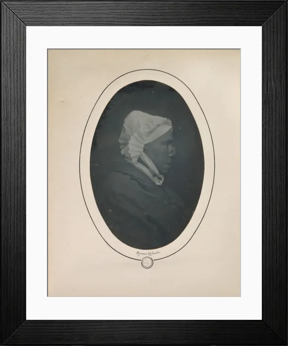 Framed Print : [Profile of a Woman with Necrosis of the Nose], 1841-48. Creator: Louis-Auguste Bisson
