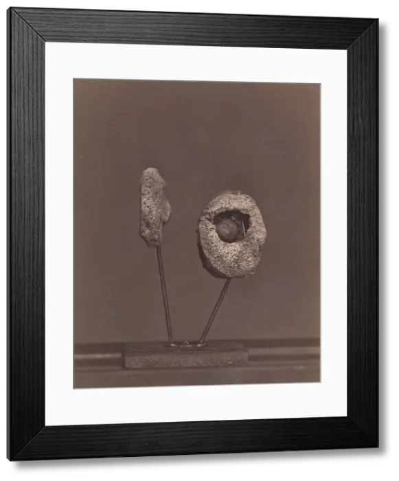 Framed Print : Excised Knee Joint. A Round Musket Ball in the Inner Condyle of the Right Femur [Gardin Framed Print : Excised Knee Joint. A Round Musket Ball in the Inner Condyle of the Right Femur [Gardin