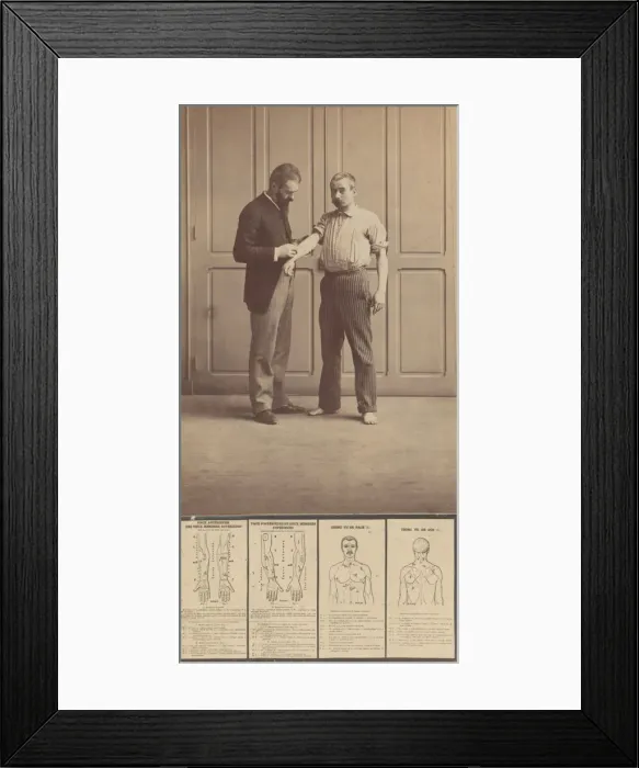 Framed Print : Notation of Scars, Schematic Drawings, ca. 1893. ca. 1893. Creator: Alphonse Bertillon Framed Print : Notation of Scars, Schematic Drawings, ca. 1893. ca. 1893. Creator: Alphonse Bertillon