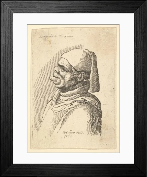 Framed Print : Bust of a deformed man with a hat and a fat, protruding lower lip in profile to left Framed Print : Bust of a deformed man with a hat and a fat, protruding lower lip in profile to left