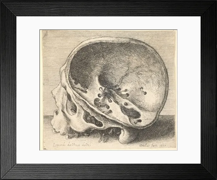 Framed Print : Sectioned skull in profile to left with the left side of the cranium removed, 1651 Framed Print : Sectioned skull in profile to left with the left side of the cranium removed, 1651