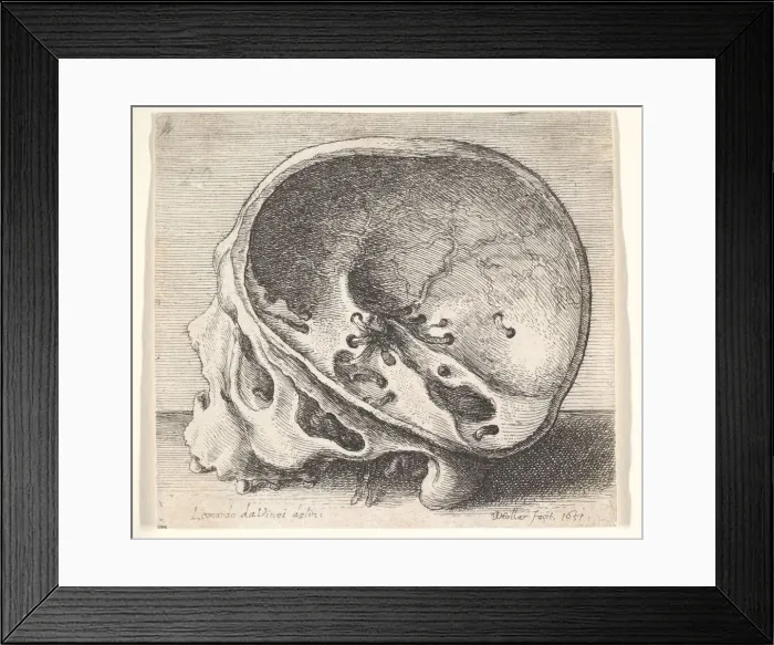 Framed Print : Sectioned skull in profile to left with the left side of the cranium removed, 1651 Framed Print : Sectioned skull in profile to left with the left side of the cranium removed, 1651