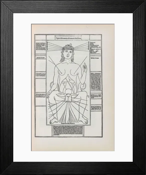 Framed Print : Illustration from Fasciculo di medicina'by Johannes de Ketham, 1493 Framed Print : Illustration from Fasciculo di medicina'by Johannes de Ketham, 1493