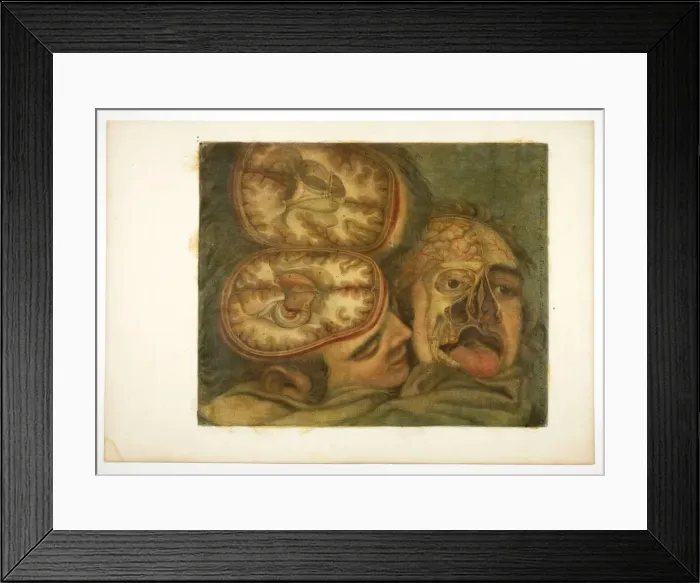 Framed Print : Cranial Dissection, plate five from Anatomy of the Head, in Printed Paintings, 1748. Creator: Jacques Fabian Gautier Dagoty Framed Print : Cranial Dissection, plate five from Anatomy of the Head, in Printed Paintings, 1748. Creator: Jacques Fabian Gautier Dagoty