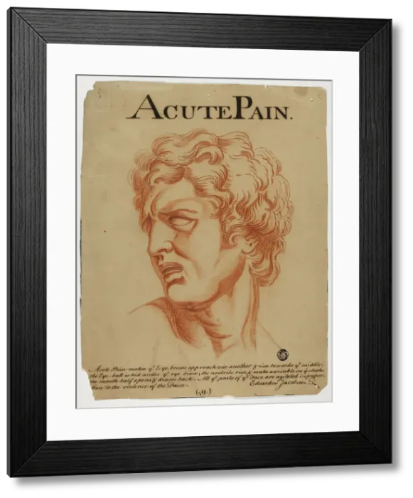 Framed Print : Acute Pain, after 1698. Creator: Eduardus Jacobus Framed Print : Acute Pain, after 1698. Creator: Eduardus Jacobus