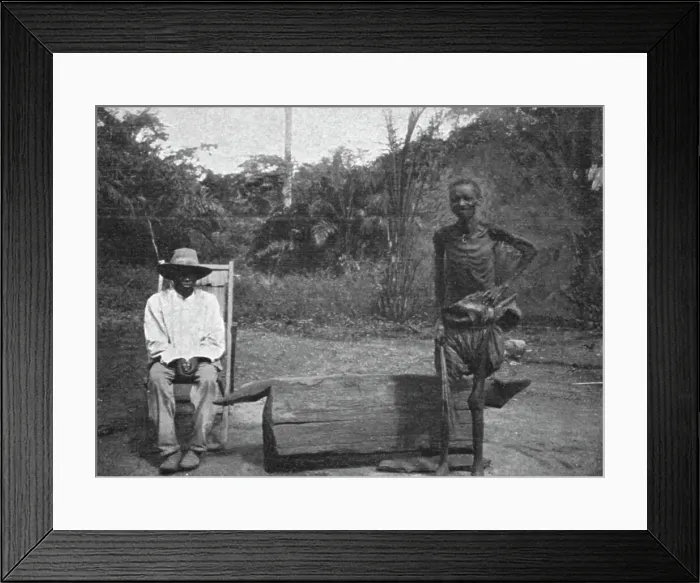 Framed Print : Indigene du Congo atteint de la maladie du sommeil; L'Ouest Africain, 1914. Creator: Unknown Framed Print : Indigene du Congo atteint de la maladie du sommeil; L'Ouest Africain, 1914. Creator: Unknown