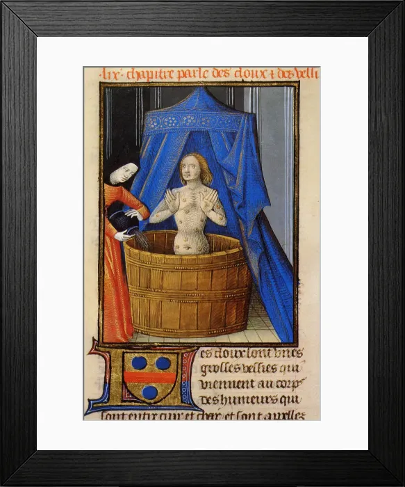 Framed Print : Treatment of boils with a hot herbal bath. From Livre des propriétés des choses by Barthélemy l'Angl Creator: Anonymous Framed Print : Treatment of boils with a hot herbal bath. From Livre des propriétés des choses by Barthélemy l'Angl Creator: Anonymous