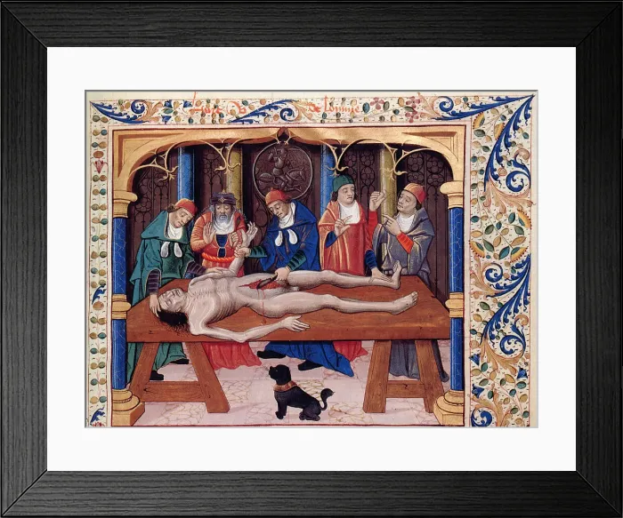 Framed Print : Autopsy. From Livre des propriétés des choses by Barthélemy l'Anglais, 15th century. Creator: Anonymous Framed Print : Autopsy. From Livre des propriétés des choses by Barthélemy l'Anglais, 15th century. Creator: Anonymous