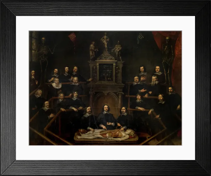 Framed Print : The Anatomy Lesson of Doctor Joannes van Buyten in the Surgeon's Room in Antwerp, 1660. Creator: Frans Denys Framed Print : The Anatomy Lesson of Doctor Joannes van Buyten in the Surgeon's Room in Antwerp, 1660. Creator: Frans Denys