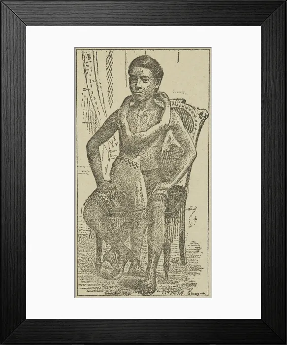 Framed Print : Lalloo, The Greatest Living Wonder on Earth, 1887. Creator: Unknown Framed Print : Lalloo, The Greatest Living Wonder on Earth, 1887. Creator: Unknown