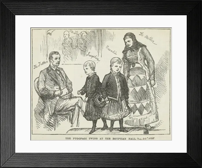 Framed Print : The Pyopagi Twins shown at Egyptian Hall, 1880. Creator: Unknown Framed Print : The Pyopagi Twins shown at Egyptian Hall, 1880. Creator: Unknown