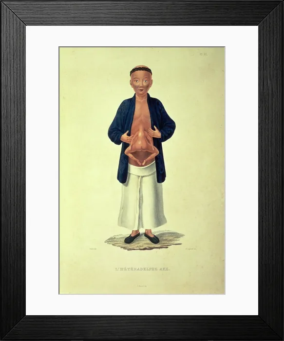 Framed Print : L'heteradelphe Ake, c1824-c1826. Creator: H Legrand. L'heteradelphe Ake, c1824-c1826. Creator: H Legrand Framed Print : L'heteradelphe Ake, c1824-c1826. Creator: H Legrand. L'heteradelphe Ake, c1824-c1826. Creator: H Legrand