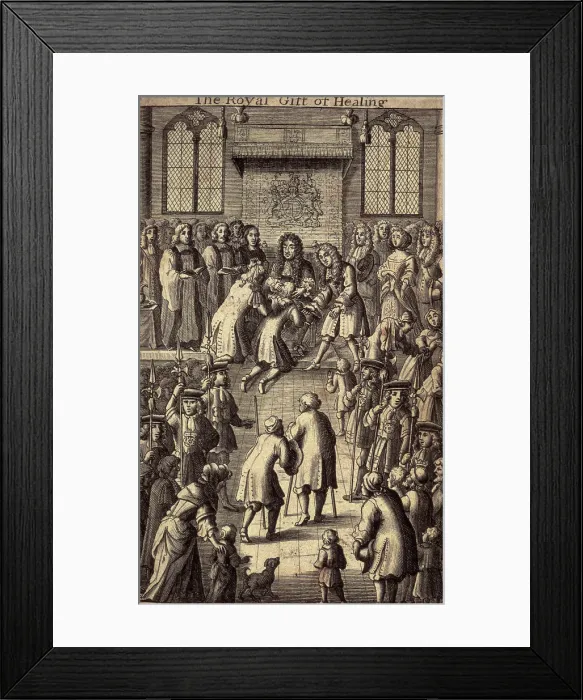 Framed Print : The Royal Gift of Healing, King Charles II healing the sick, 1684. Creator: Unknown. The Royal Gift of Healing, King Charles II healing the sick, 1684 Framed Print : The Royal Gift of Healing, King Charles II healing the sick, 1684. Creator: Unknown. The Royal Gift of Healing, King Charles II healing the sick, 1684