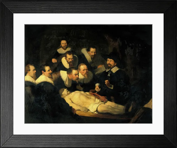 Framed Print : The anatomy of Dr Nicolaes Tulp. Creator: Rembrandt Harmenszoon van Rijn, 1606-1669 (After) Framed Print : The anatomy of Dr Nicolaes Tulp. Creator: Rembrandt Harmenszoon van Rijn, 1606-1669 (After)