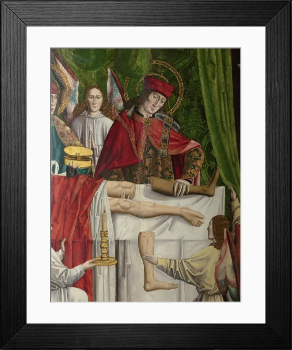 Framed Print : A verger's dream: Saints Cosmas and Damian performing a miraculous cure by transplant... 1495. Creator: Master of Balbases. A verger's dream: Saints Cosmas and Damian performing a miraculous cure by transplant... 1495 Framed Print : A verger's dream: Saints Cosmas and Damian performing a miraculous cure by transplant... 1495. Creator: Master of Balbases. A verger's dream: Saints Cosmas and Damian performing a miraculous cure by transplant... 1495
