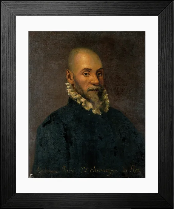 Framed Print : Ambroise Pare (1510-1590), surgeon, 17th (?) century. Creator: Unknown Framed Print : Ambroise Pare (1510-1590), surgeon, 17th (?) century. Creator: Unknown