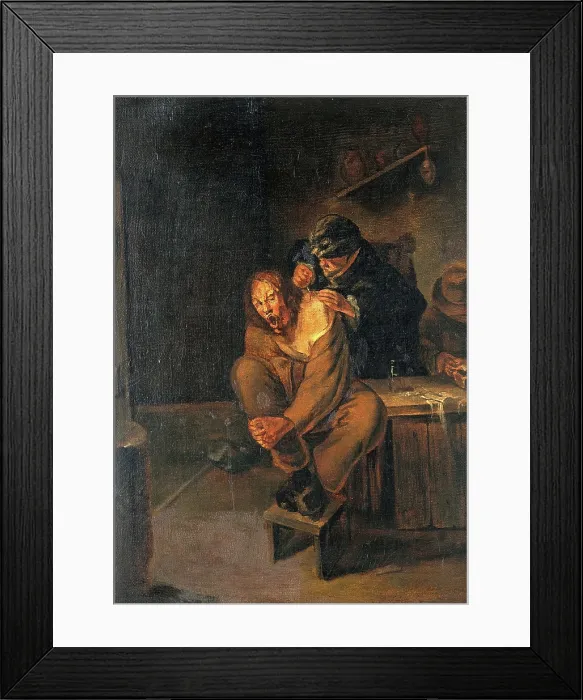 Framed Print : A surgeon operating on a man's shoulder, c1640s. Creator: Unknown. A surgeon operating on a man's shoulder, c1640s. Creator: Unknown Framed Print : A surgeon operating on a man's shoulder, c1640s. Creator: Unknown. A surgeon operating on a man's shoulder, c1640s. Creator: Unknown