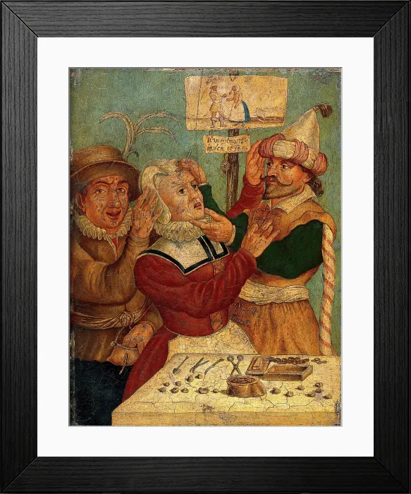 Framed Print : A surgeon extracting pierres de tete, c1660s. Creator: Unknown