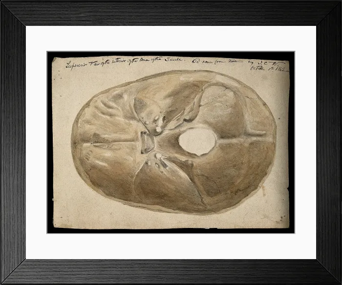 Framed Print : Interior of the base of the human skull, 1854 / 03 / 16. Creator: J.C. Whishaw Framed Print : Interior of the base of the human skull, 1854 / 03 / 16. Creator: J.C. Whishaw