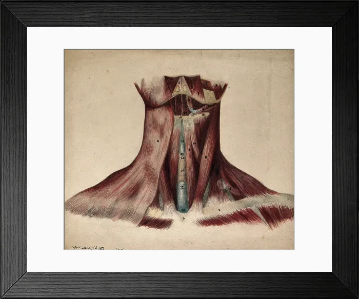 Framed Print : Dissection of the back of the neck, 1854 / 03 / 16. Creator: J.C. Whishaw Framed Print : Dissection of the back of the neck, 1854 / 03 / 16. Creator: J.C. Whishaw