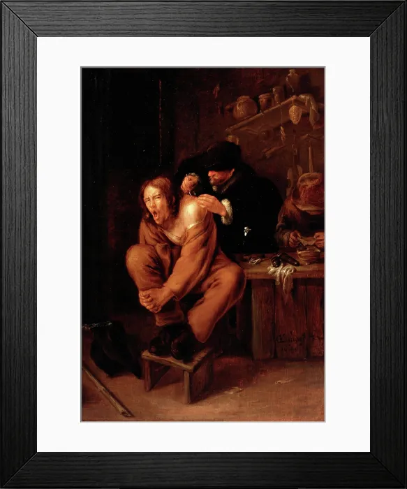 Framed Print : A surgeon applying medicine to a wound in the shoulder of a man in pain, 1649. Creator: Gerrit Lundens Framed Print : A surgeon applying medicine to a wound in the shoulder of a man in pain, 1649. Creator: Gerrit Lundens