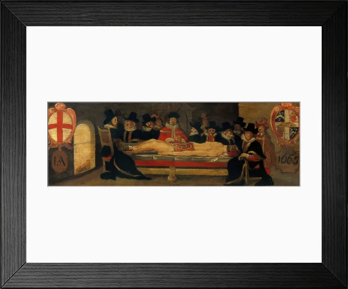 Framed Print : The dissection of a corpse before a company of surgeons, c1665. Creator: Unknown Framed Print : The dissection of a corpse before a company of surgeons, c1665. Creator: Unknown