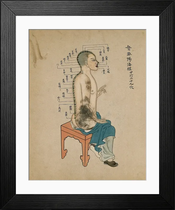 Framed Print : Acupuncture chart with a series of points indicated on the figure of a seated Chinese man, 1700-1799 Creator: Unknown Framed Print : Acupuncture chart with a series of points indicated on the figure of a seated Chinese man, 1700-1799 Creator: Unknown