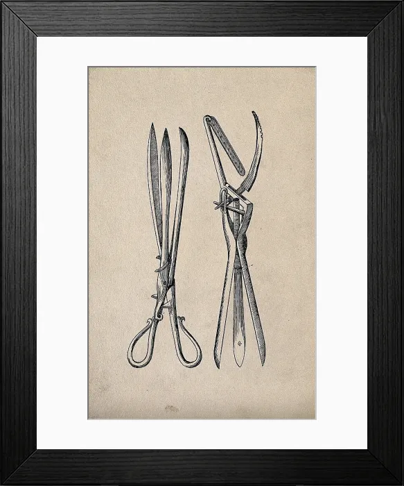 Framed Print : Surgical instrument. Creator: Unknown Framed Print : Surgical instrument. Creator: Unknown