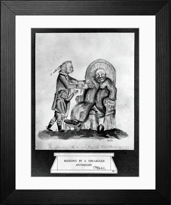 Framed Print : A surgeon-apothecary bleeding a patient, his servant boy catches the drops. Creator: Unknown Framed Print : A surgeon-apothecary bleeding a patient, his servant boy catches the drops. Creator: Unknown