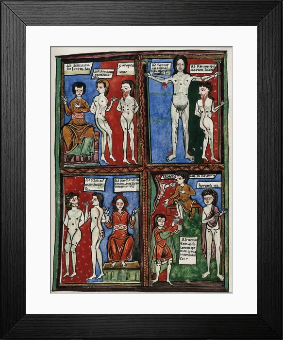 Framed Print : Four vignettes demonstrating different cauterisation points on naked human bodies. Creator: Unknown Framed Print : Four vignettes demonstrating different cauterisation points on naked human bodies. Creator: Unknown