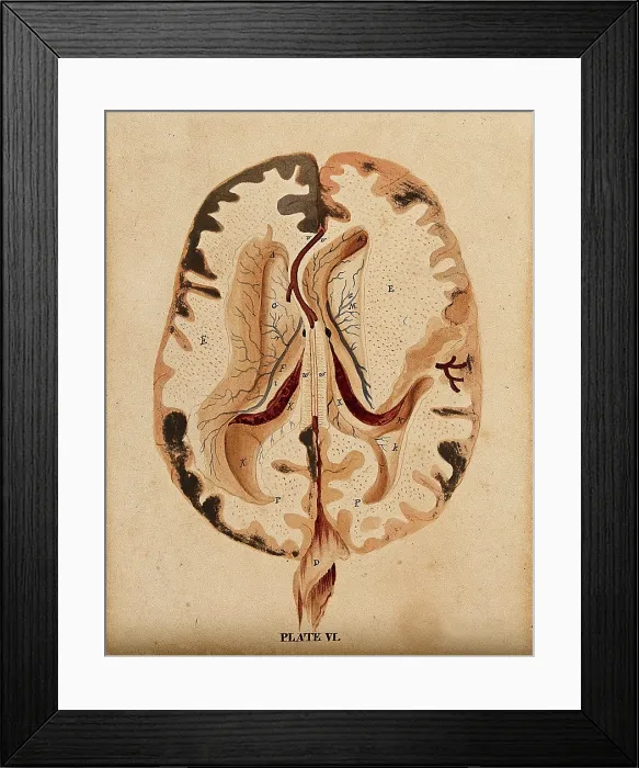 Framed Print : Brain: horizontal section showing lateral ventricles, 1820-1827. Creator: William Home Lizars Framed Print : Brain: horizontal section showing lateral ventricles, 1820-1827. Creator: William Home Lizars