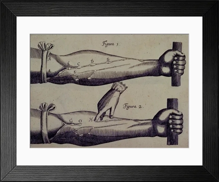 Framed Print : Two arms, and a finger pointing towards a vein, 1628. Creator: Unknown Framed Print : Two arms, and a finger pointing towards a vein, 1628. Creator: Unknown
