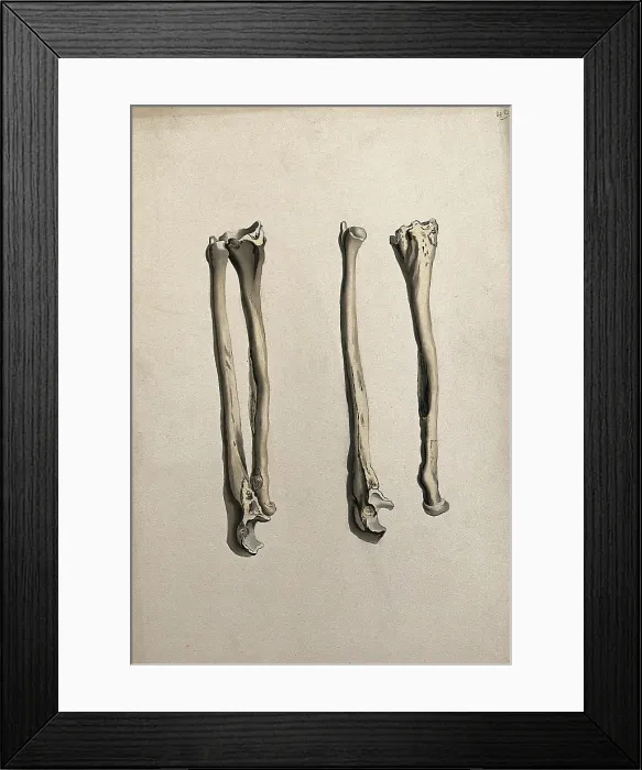 Framed Print : Radius and ulna bones: two figures, 1830-1835. Creator: Unknown Framed Print : Radius and ulna bones: two figures, 1830-1835. Creator: Unknown
