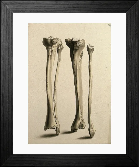 Framed Print : Tibia and fibula bones, 1830-1835. Creator: Unknown Framed Print : Tibia and fibula bones, 1830-1835. Creator: Unknown