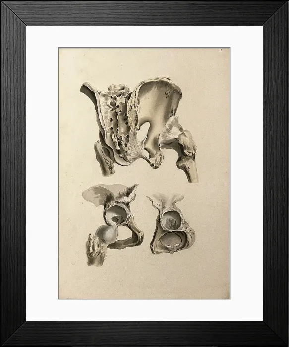 Framed Print : Ligaments of hip-bone and femur (thigh-bone), 1830-1835. Creator: Unknown Framed Print : Ligaments of hip-bone and femur (thigh-bone), 1830-1835. Creator: Unknown
