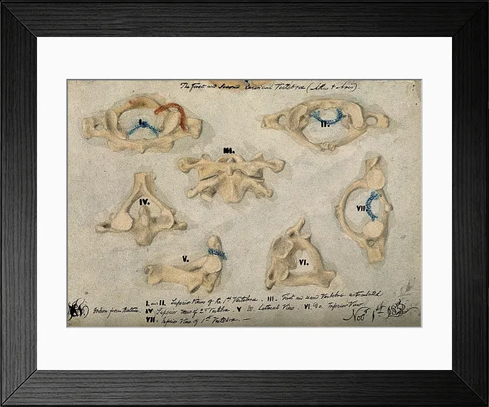 Framed Print : The first and second cervical vertebrae, 1852 / 11 / 09. Creator: J.C. Whishaw Framed Print : The first and second cervical vertebrae, 1852 / 11 / 09. Creator: J.C. Whishaw
